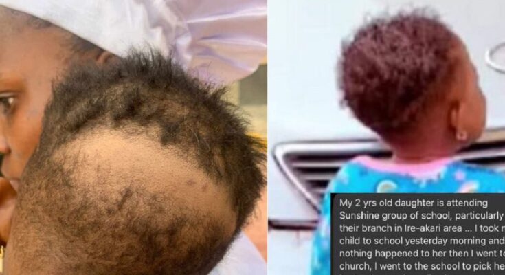 Mother Cries out in Ibadan