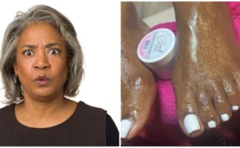 Woman shows pedicure before and after pictures