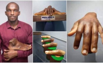Nigerian sculptor becomes first to create hyper realistic prosthetics for black amputees | Ikejabird.com