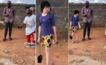 Albino lady rates man she met on blind date zero | Ikejabird.com