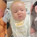 Mum shares story of how her cute baby was diagnosed with albinism