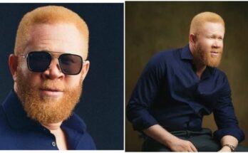 Nigerian albino actor shares early struggles in the movie industry | Ikejabird.com