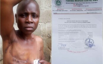 Help Florence Ajayi beat cancer