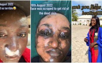 Lady narrates horrible lab experiment, shows road to healing