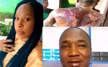 Woman arrested for pouring hot groundnut oil on husband