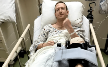 Mark Zuckerberg undergoes knee surgery