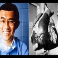 Dr. Victor Chang: Pioneer of modern heart transplant surgery