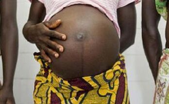 Pregnant women waiting for maternal healthcare services at a hospital